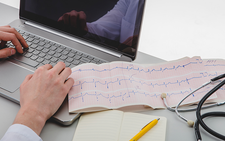 Palpitaciones o arritmias